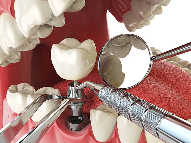 Best Weekend Emergency Dentist in Mokena, IL